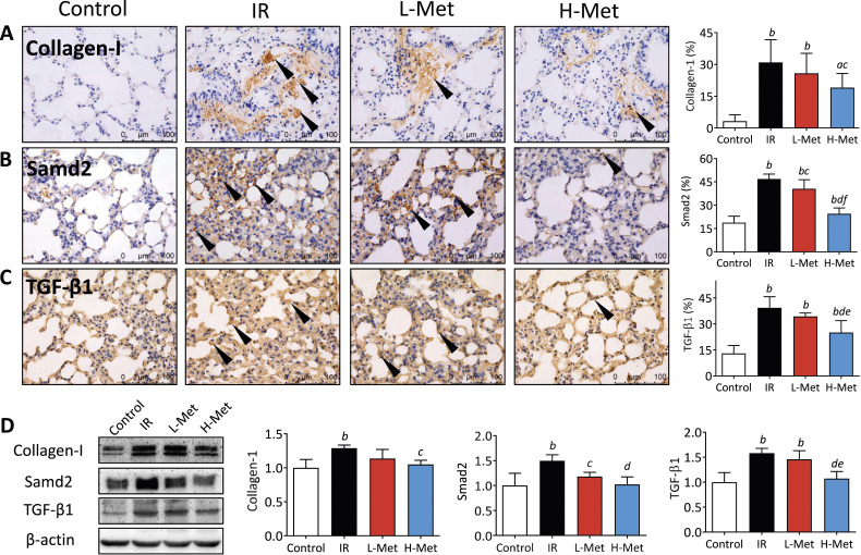 The Effect of Metformin on Radiation-Induced Lung Fibrosis in Mice.