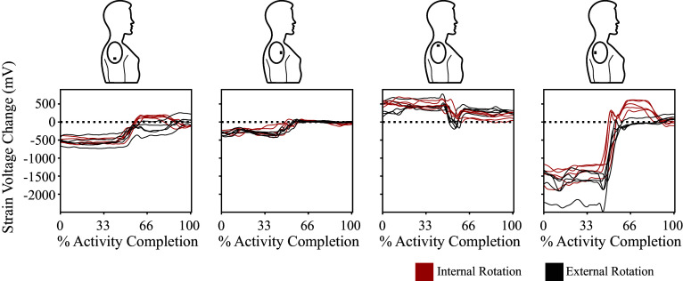 Identifying internal and external shoulder rotation using a kirigami-based shoulder patch.