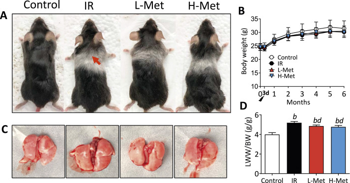 The Effect of Metformin on Radiation-Induced Lung Fibrosis in Mice.