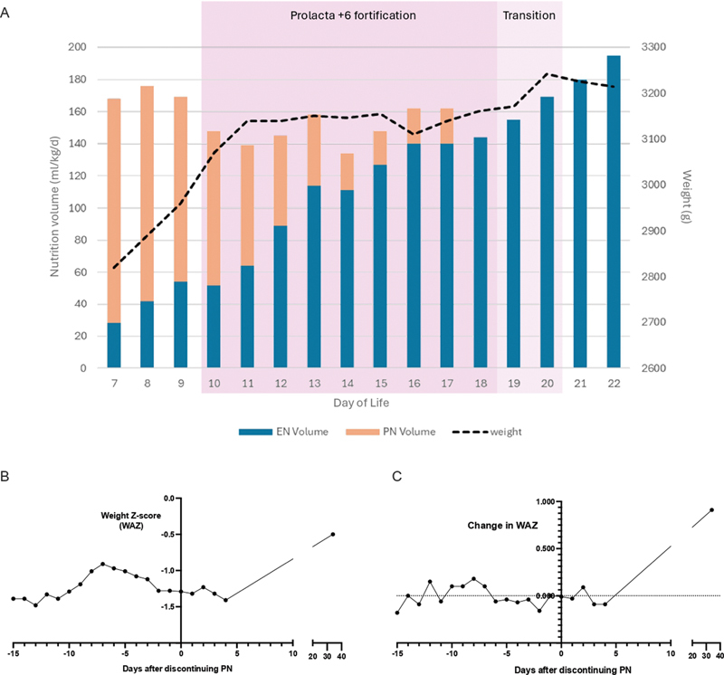 Human Milk-Derived Fortifier to Reduce Hospital-Acquired Malnutrition in Uncomplicated Gastroschisis: A Case Report.