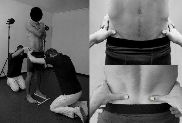 The Association between Pelvic Asymmetry and Lateral Abdominal Muscle Activity in a Healthy Population.