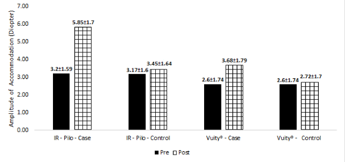 Pharmacological Treatment of Presbyopia Using Pilocarpine 1.25% Eye Drops.
