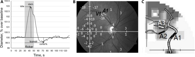Eye yoga for glaucoma: recovery of vascular dysregulation and visual field function-a randomized controlled trial.