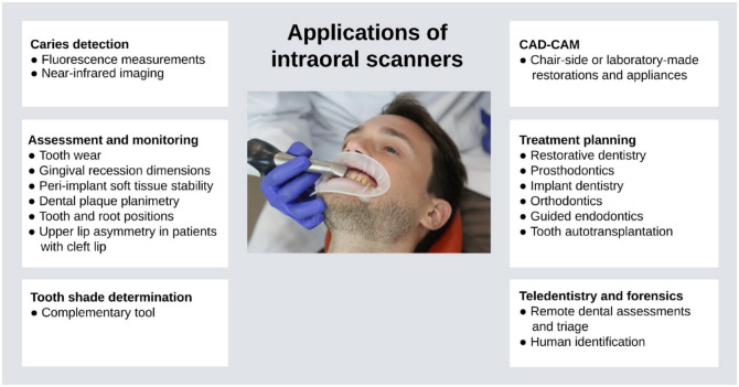 Recent Advances in Intraoral Scanners.