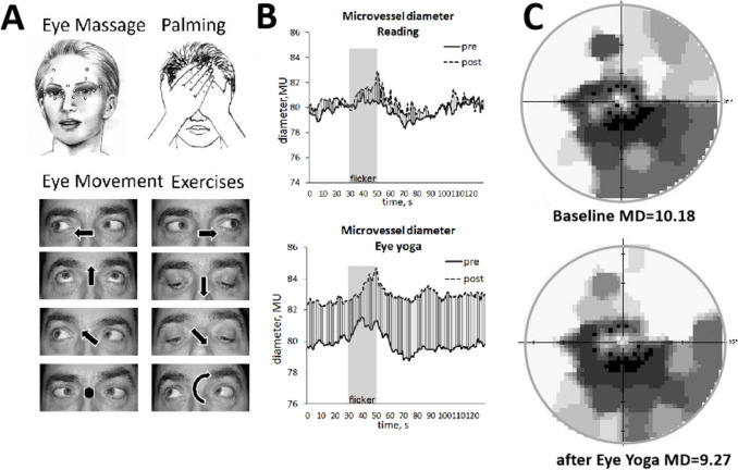 Eye yoga for glaucoma: recovery of vascular dysregulation and visual field function-a randomized controlled trial.