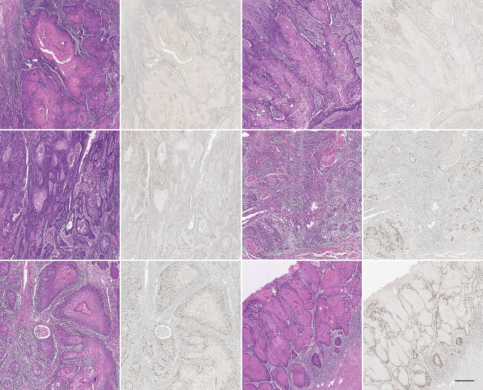 Leveraging deep learning for identification and segmentation of “CAF-1/p60-positive” nuclei in oral squamous cell carcinoma tissue samples