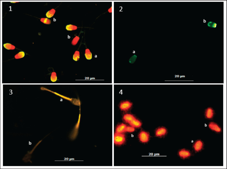 The frozen-thawed sperm protein of Indonesian Toraya buffaloes is significantly associated with sperm kinematics, acrosome integrity, and mitochondrial membrane potential.
