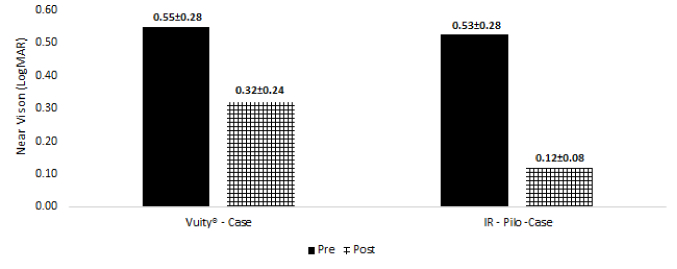Pharmacological Treatment of Presbyopia Using Pilocarpine 1.25% Eye Drops.