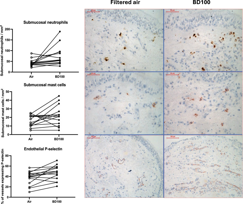 Acute airway inflammation following controlled biodiesel exhaust exposure in healthy subjects.
