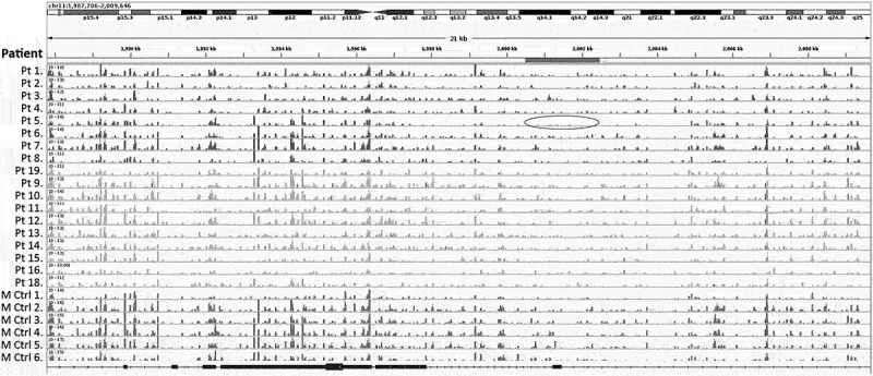 Genome-wide methylation analysis in patients with proximal hypospadias - a pilot study and review of the literature.