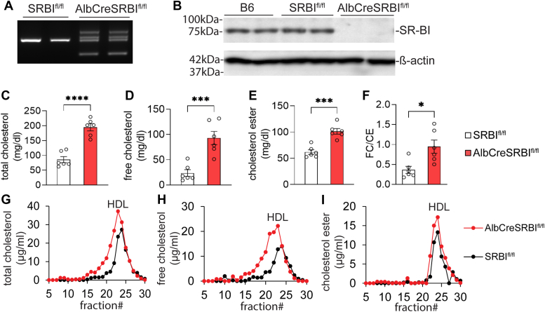 Elevated free cholesterol levels due to impaired reverse cholesterol transport are a risk factor for polymicrobial sepsis in mice.