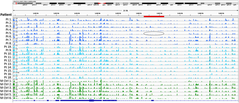 Genome-wide methylation analysis in patients with proximal hypospadias - a pilot study and review of the literature.