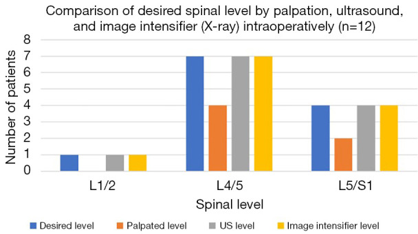 'The Stegosaurus Appearance' on ultrasound to assist in identifying the correct spinal level for primary lumbar spinal surgery.