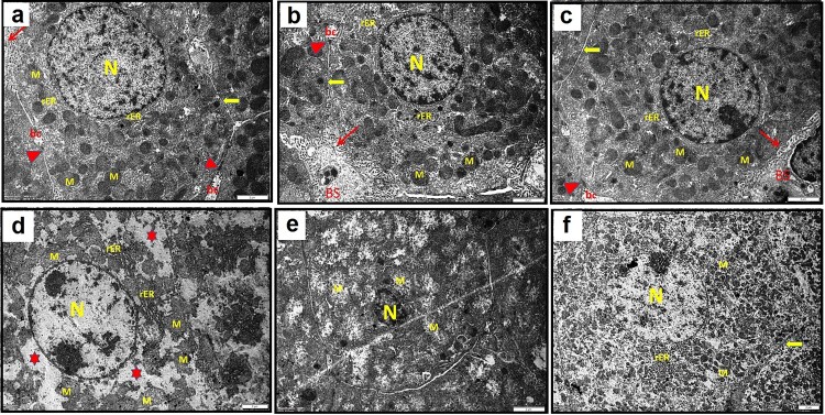 Implication of endoplasmic reticulum stress and mitochondrial perturbations in remote liver injury after renal ischemia/reperfusion in rats: potential protective role of azilsartan.