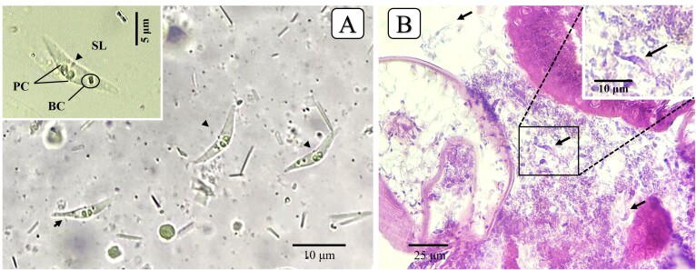 A new Ceratomyxa (Cnidaria: Myxosporea) infecting the ornamental fish species Pterophyllum scalare from the Amazon Region, Brazil.