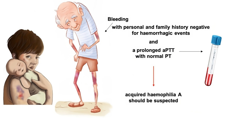 Role of the Hemostasis and Thrombosis Unit in the Management of Patients with Acquired Hemophilia A