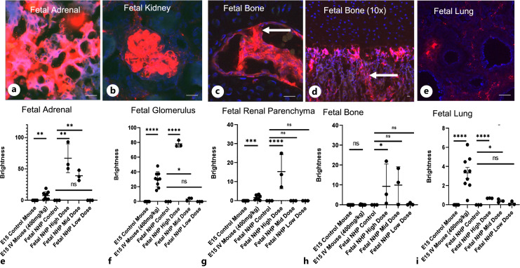 Biodistribution of Polymeric Nanoparticles following in utero Delivery to a Nonhuman Primate.
