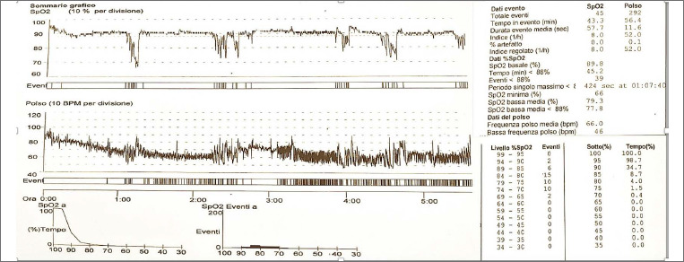 Severe progressive respiratory involvement requiring ventilator support in autosomal recessive Bethlem myopathy. A case report.