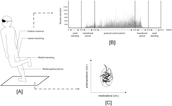 Influence of Hamstring Injuries and Vision on Posterior Chain Muscle Activation during Challenging Single-Limb Balance Control among Athletes with Hamstring Strain Injuries.
