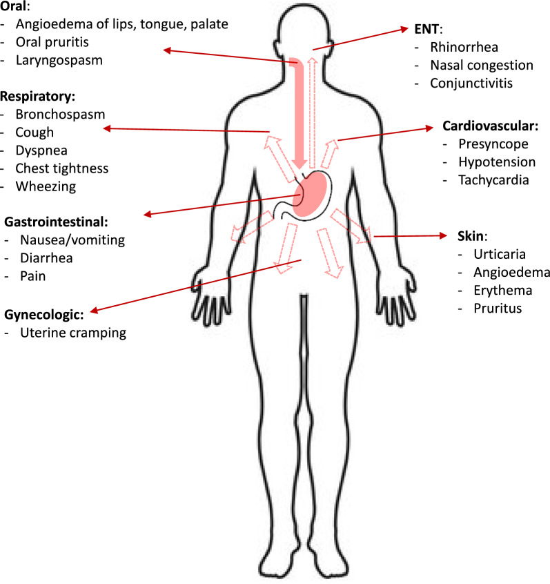 Immunoglobulin E (IgE)-mediated food allergy.