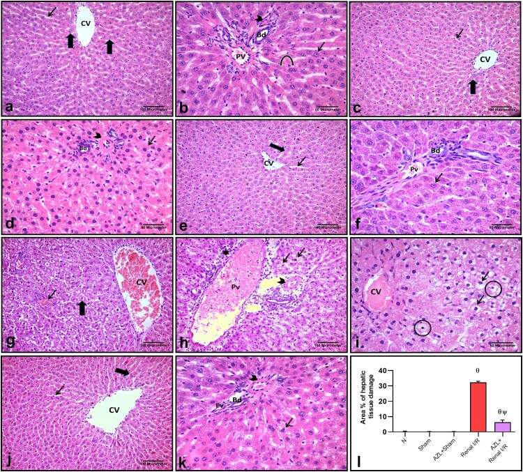 Implication of endoplasmic reticulum stress and mitochondrial perturbations in remote liver injury after renal ischemia/reperfusion in rats: potential protective role of azilsartan.