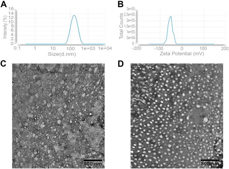Genistein transfersome-embedded topical delivery system for skin melanoma treatment: <i>in vitro</i> and <i>ex vivo</i> evaluations.