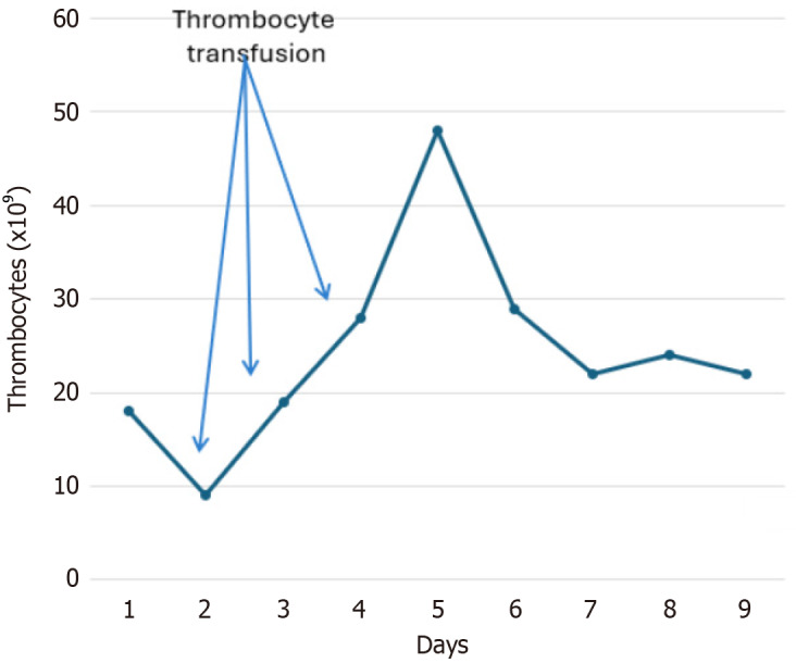 Angiotensin II administration in severe thrombocytopenia and chronic venous thrombosis: A case report.