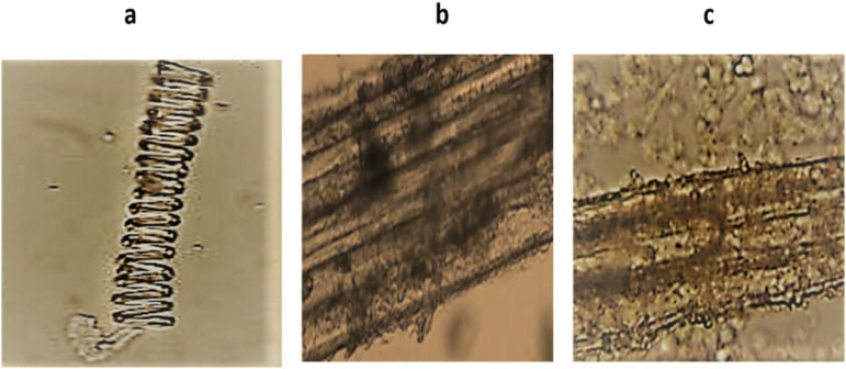 Antimicrobial and Hepatoprotective Properties of Pods of <i>Acacia nilotica</i> (L.) Willd. ex Delile: <i>In Vivo</i> and <i>In Silico</i> Approaches.