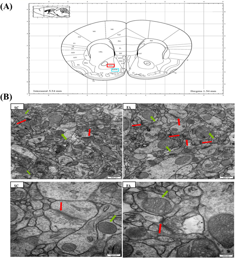 Synaptic Structure and Transcriptomic Profiling of Reward and Sensory Brain Areas in Male Mice of Fentanyl Addiction.