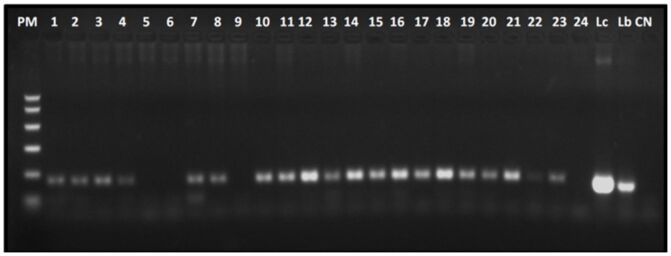 Occurrence of Leishmania spp. DNA and specific antibodies in dogs from Acre State, Rio Branco, Brazil.