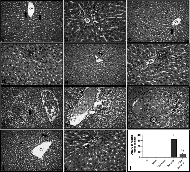 Implication of endoplasmic reticulum stress and mitochondrial perturbations in remote liver injury after renal ischemia/reperfusion in rats: potential protective role of azilsartan.
