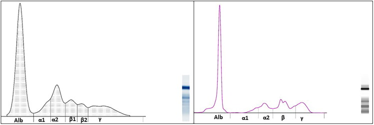 Serum protein electrophoresis in European mink (<i>Mustela lutreola</i>): reference intervals and comparison of agarose gel electrophoresis and capillary zone electrophoresis.