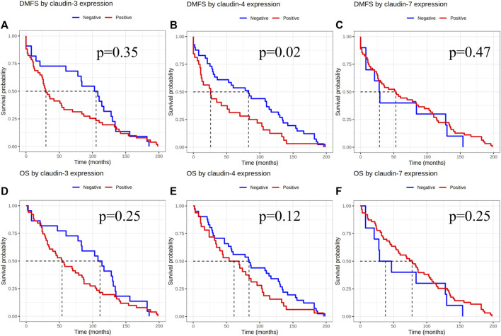 Invasive micropapillary carcinoma of the breast and invasive breast carcinoma of no special type: a comparison of claudin proteins' expression and its impact on survival.