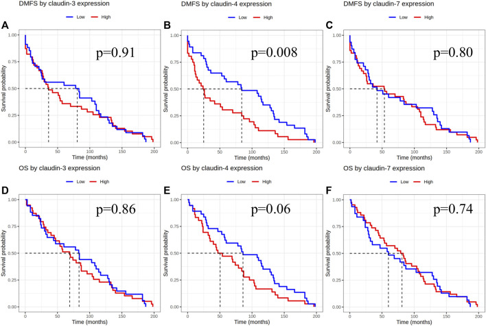 Invasive micropapillary carcinoma of the breast and invasive breast carcinoma of no special type: a comparison of claudin proteins' expression and its impact on survival.