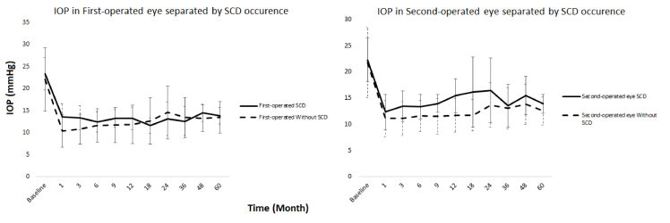 Sequential Serous Choroidal Detachment in Subjects Undergoing Bilateral Trabeculectomy.