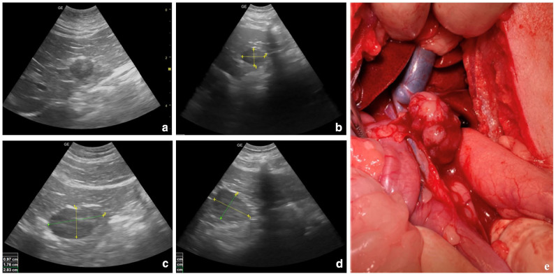 Adenocarcinoma originating from presumed liver ectopic thyroid in a cat.
