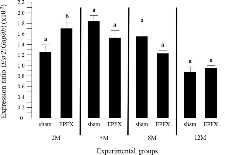 Expressional Alternation of 5α-Reductase Type I, P450 Aromatase, and Androgen and Estrogen Receptors in the Mouse Testis Induced by the Lipectomy of the Epididymal Fat at Different Postnatal Ages.
