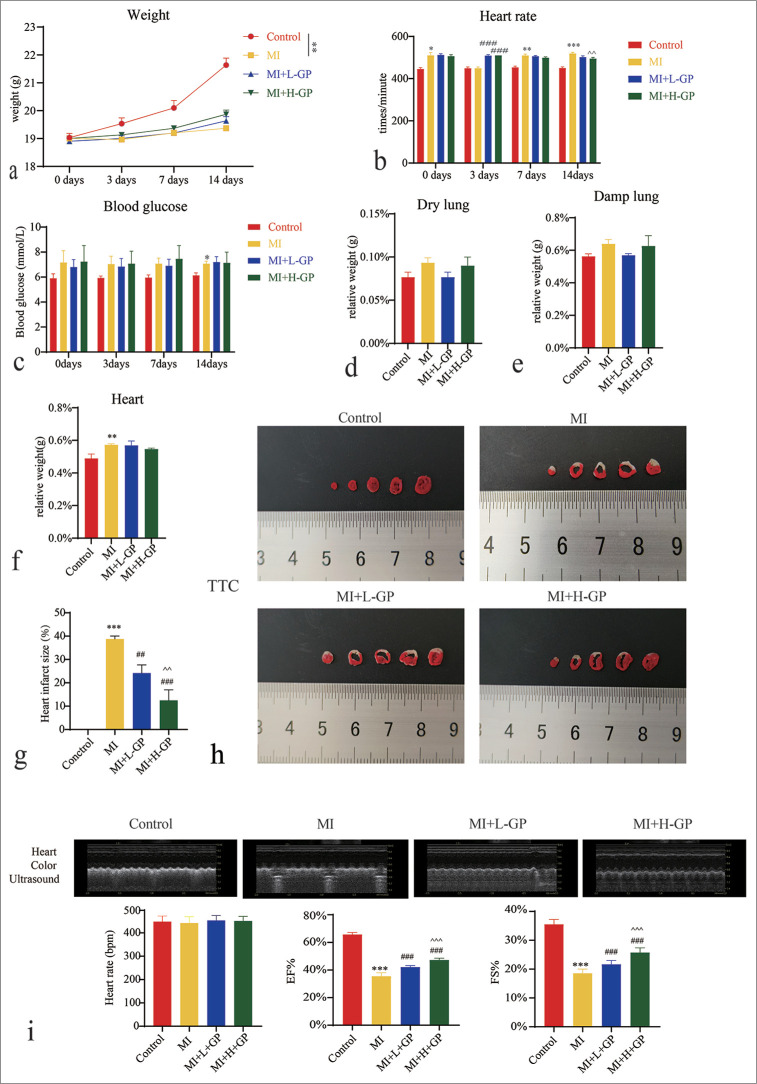 Geniposide alleviates post-myocardial infarction-induced pyroptosis by modulating the thioredoxin-interacting protein/NLRP3 signaling pathway.