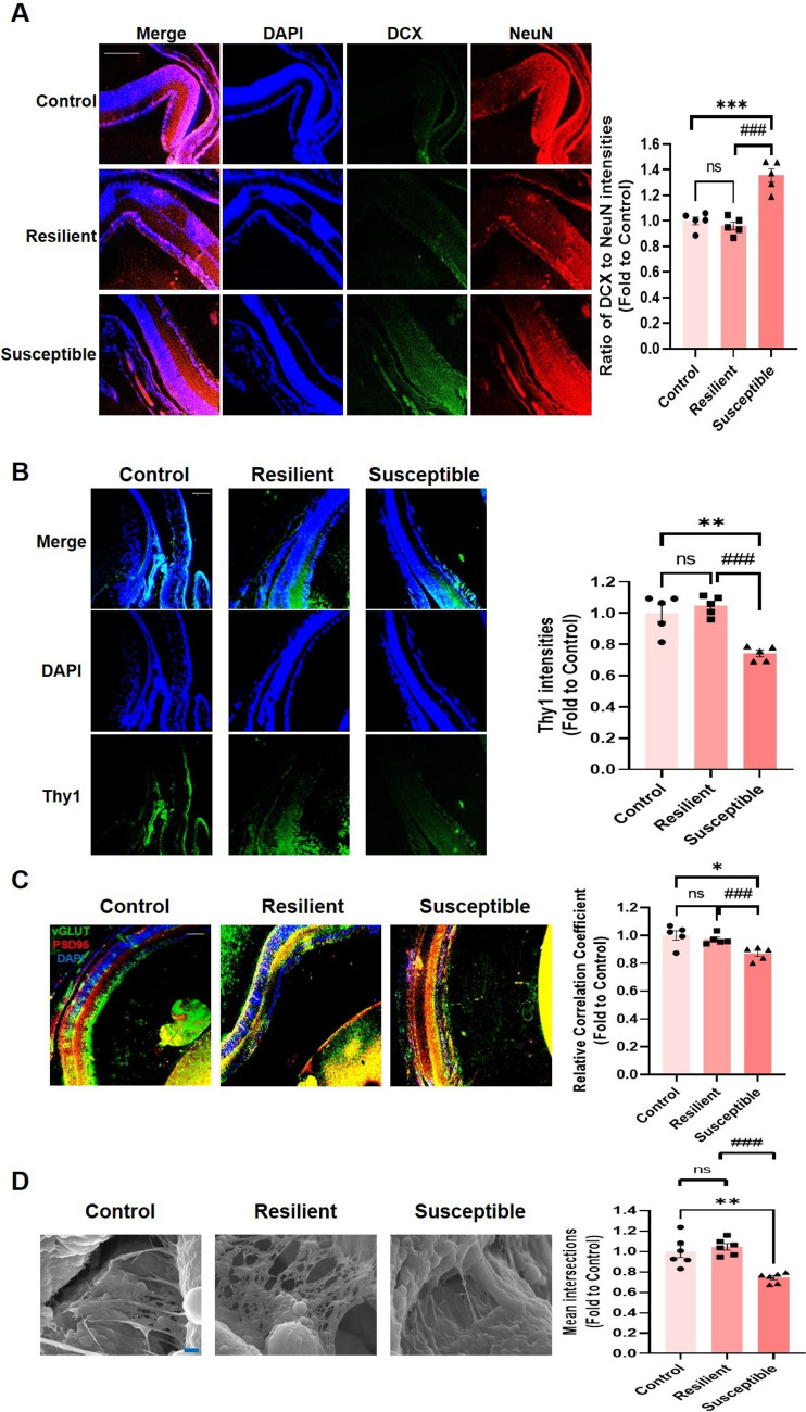 Glucocorticoid-Dependent Retinal Degeneration and Vision Impairment in Mice Susceptible to Prenatal Stress-Induced Behavioral Abnormalities.