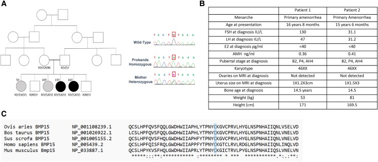 A Novel Homozygous <i>BMP15</i> Mutation Causes Ovarian Dysgenesis and Primary Amenorrhea.