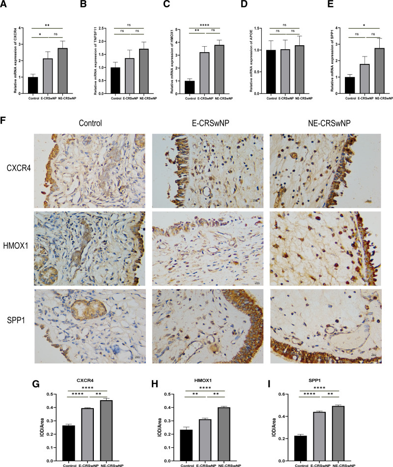 Identification and validation of autophagy-related genes and exploration of their relationship with disease severity in chronic rhinosinusitis with nasal polyps.