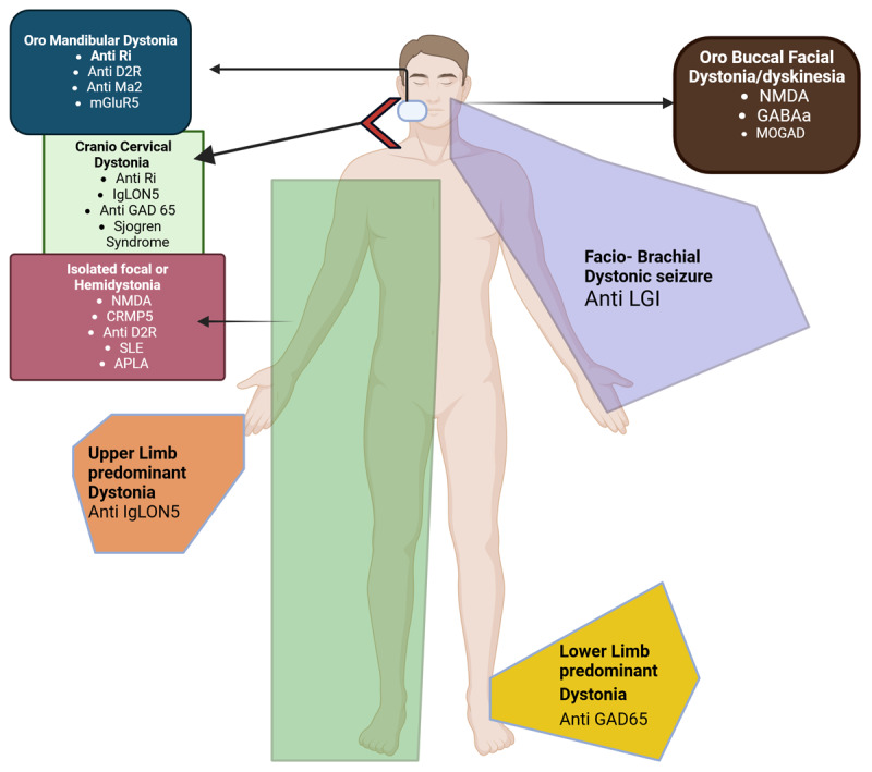 Decoding Dystonia in Autoimmune Disorders: A Scoping Review.