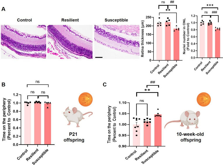 Glucocorticoid-Dependent Retinal Degeneration and Vision Impairment in Mice Susceptible to Prenatal Stress-Induced Behavioral Abnormalities.