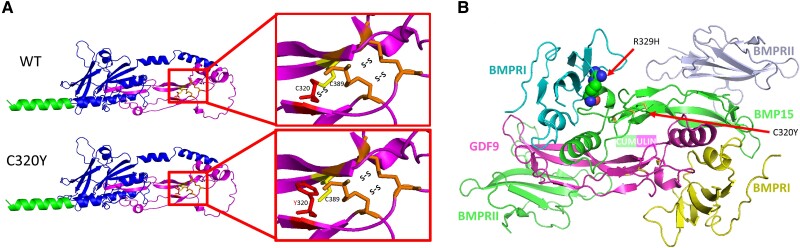 A Novel Homozygous <i>BMP15</i> Mutation Causes Ovarian Dysgenesis and Primary Amenorrhea.
