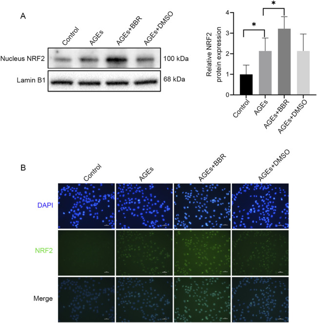 Berberine alleviates AGEs-induced ferroptosis by activating NRF2 in the skin of diabetic mice.