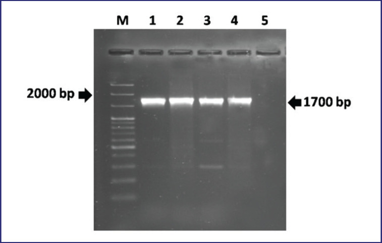 Immune response and protective efficacy of an experimentally developed inactivated oil adjuvant <i>Brucella abortus</i> vaccine in BALB/c mice.