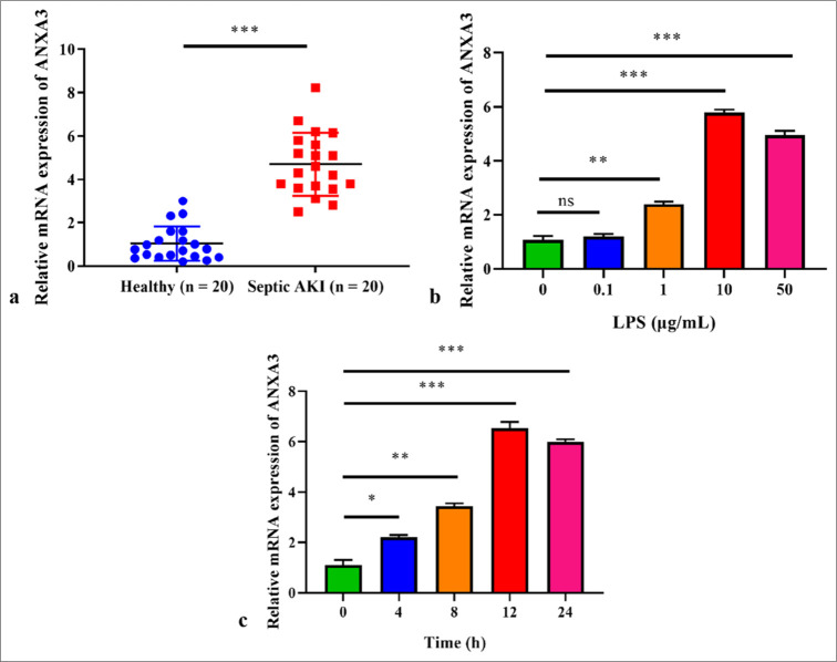 Knocking-down annexin A3 suppresses inflammation, oxidative stress, apoptosis, and endoplasmic reticulum stress to attenuate sepsis-induced acute kidney injury in HK2 cells.