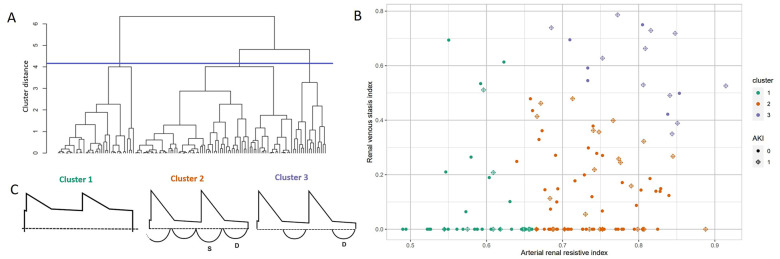 Prediction of Acute Kidney Injury After Cardiac Surgery With Combined Arterial and Venous Intrarenal Doppler.