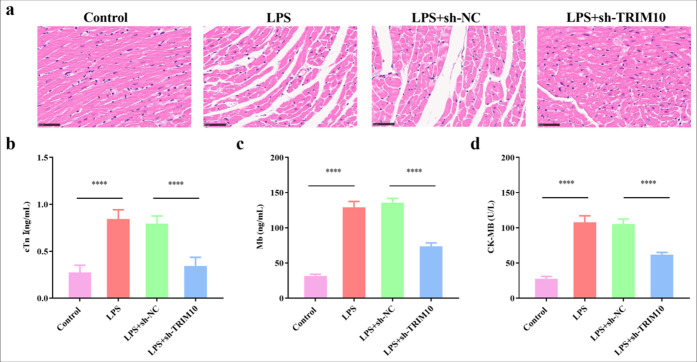 A mechanism study of tripartite motif 10 modulating septic cardiomyopathy.