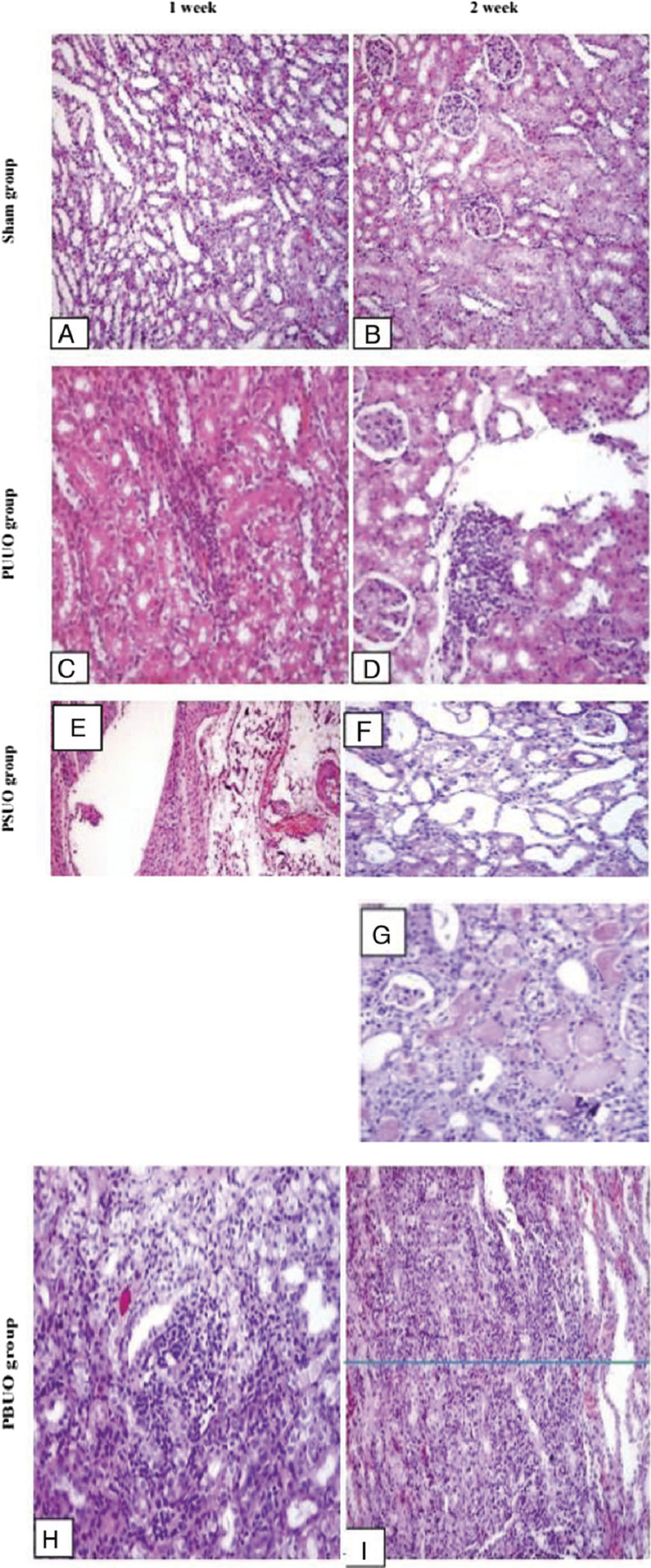 Is the urinary kidney injury molecule an optimum biomarker for early detection of obstructive nephropathy? An experimental study.